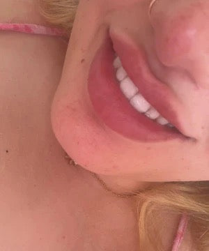 Mes dents étaient vraiment jaunes, et le résultat est bluffant dès la première utilisation. Je recommande !