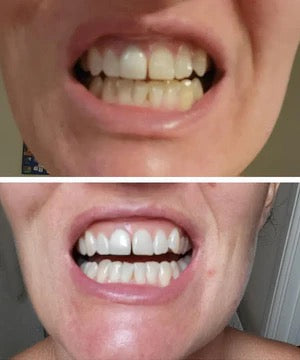 Je suis fan ! Mon sourire est éclatant et j'ai retrouvé confiance en moi.